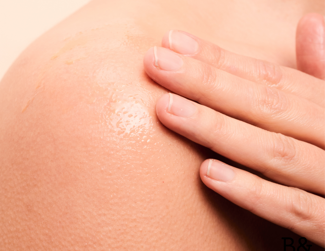 Summer skin needs aftercare